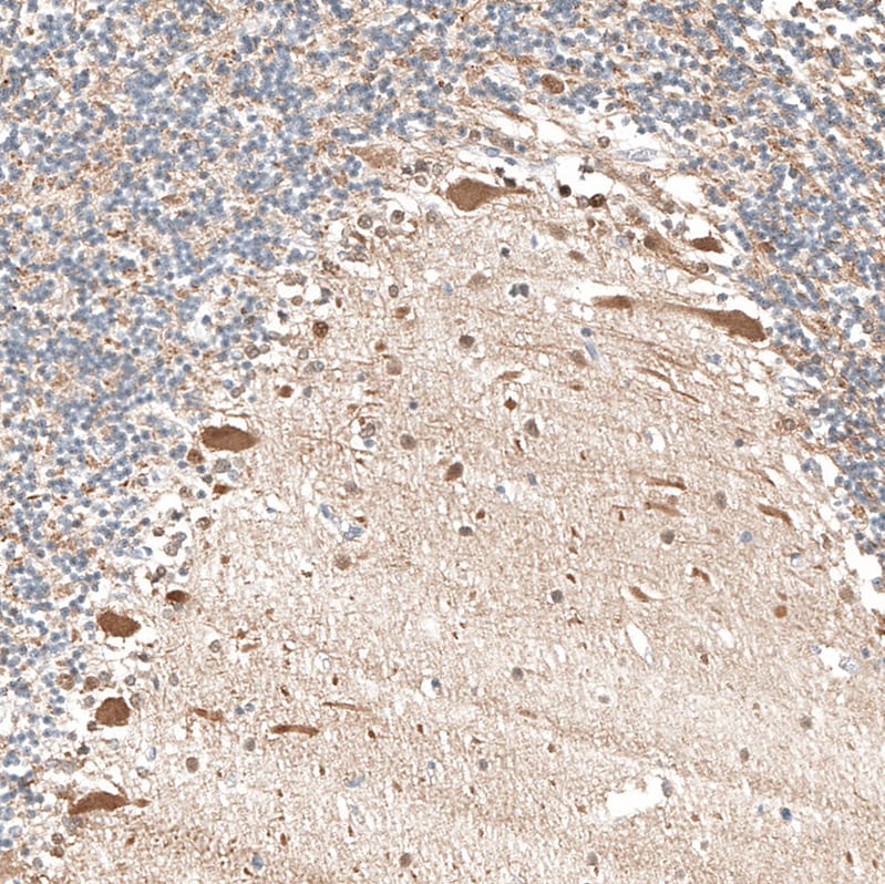 TrkA Antibody - BSA Free Immunohistochemistry-Paraffin: TrkA Antibody [NBP2-38265]
