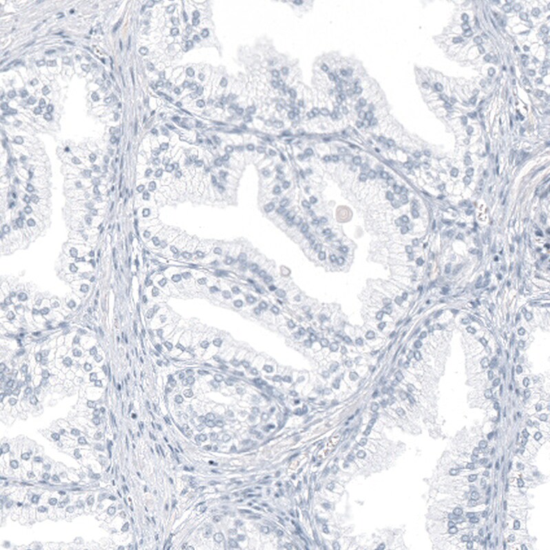 TrkA Antibody - BSA Free Immunohistochemistry-Paraffin: TrkA Antibody [NBP2-38265]