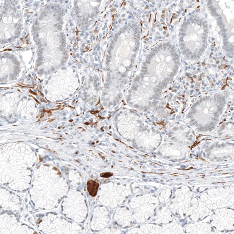 TrkA Antibody - BSA Free Immunohistochemistry-Paraffin: TrkA Antibody [NBP2-38265]