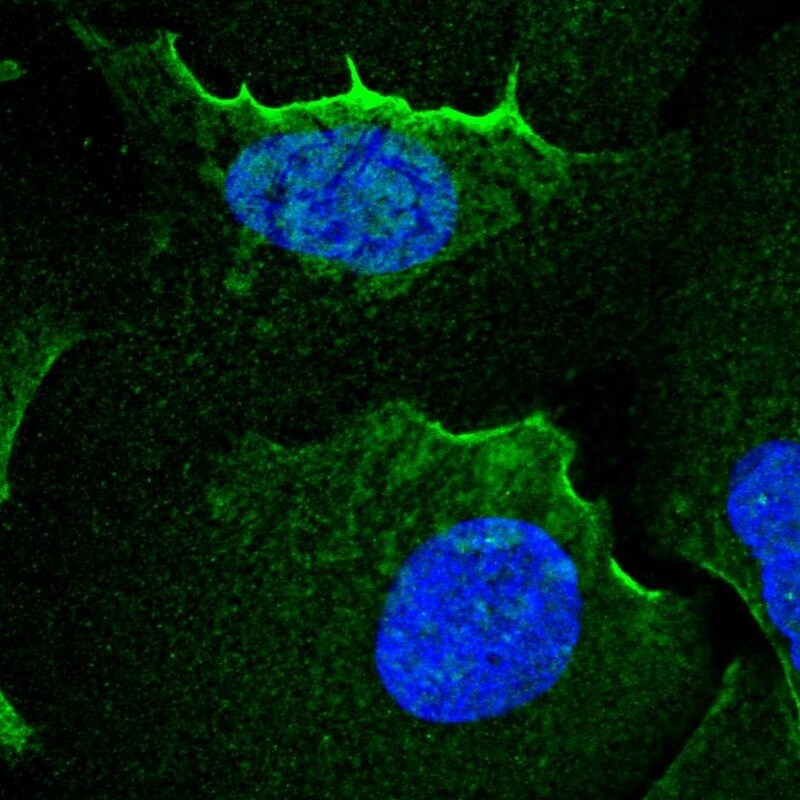alpha Adducin Antibody - BSA Free Immunocytochemistry/ Immunofluorescence: alpha Adducin Antibody [NBP2-38268]