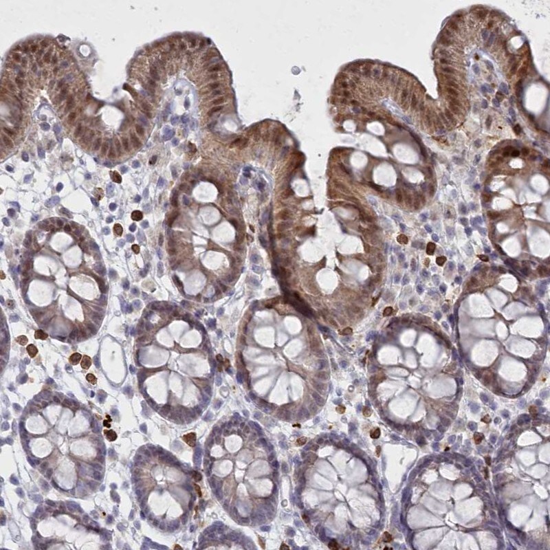 FAM206A Antibody - BSA Free Immunohistochemistry-Paraffin: FAM206A Antibody [NBP2-38273]
