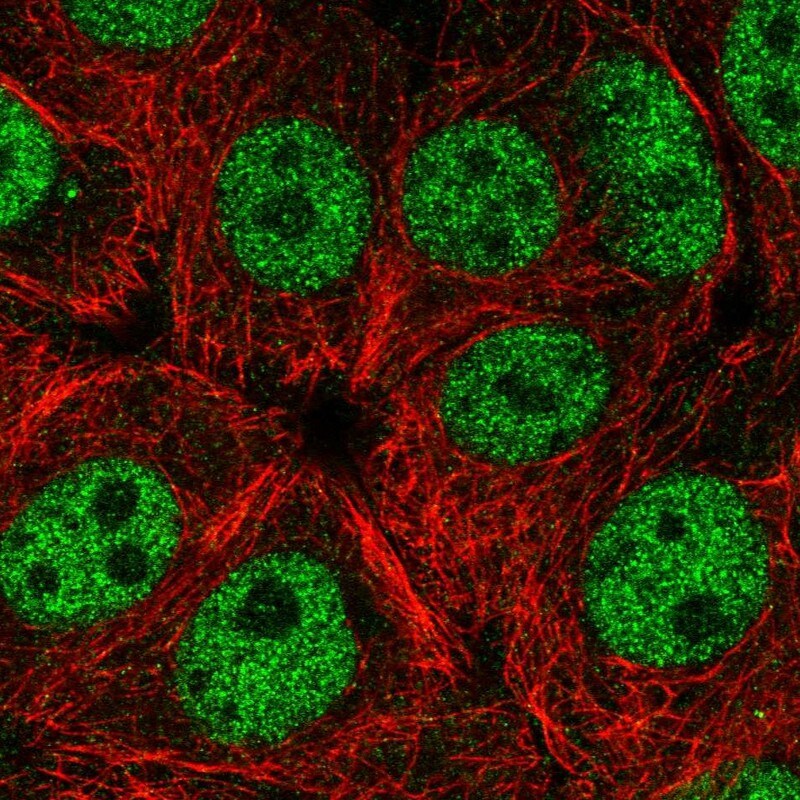 Elk-1 Antibody - BSA Free Immunocytochemistry/ Immunofluorescence: Elk-1 Antibody [NBP2-38278]