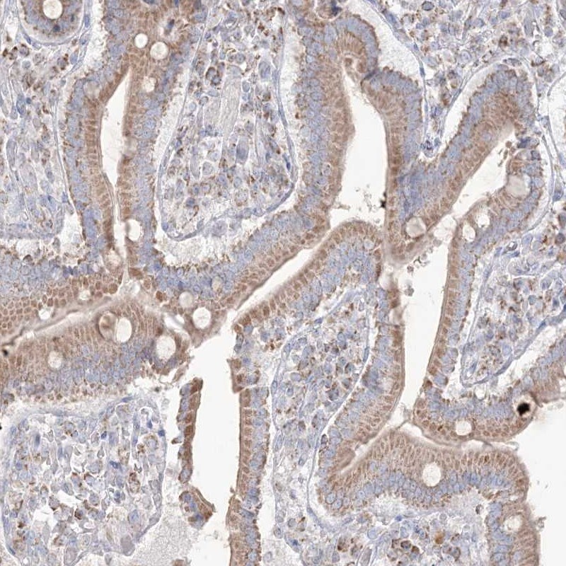 KCTD6 Antibody - BSA Free Immunohistochemistry-Paraffin: KCTD6 Antibody [NBP2-38281]