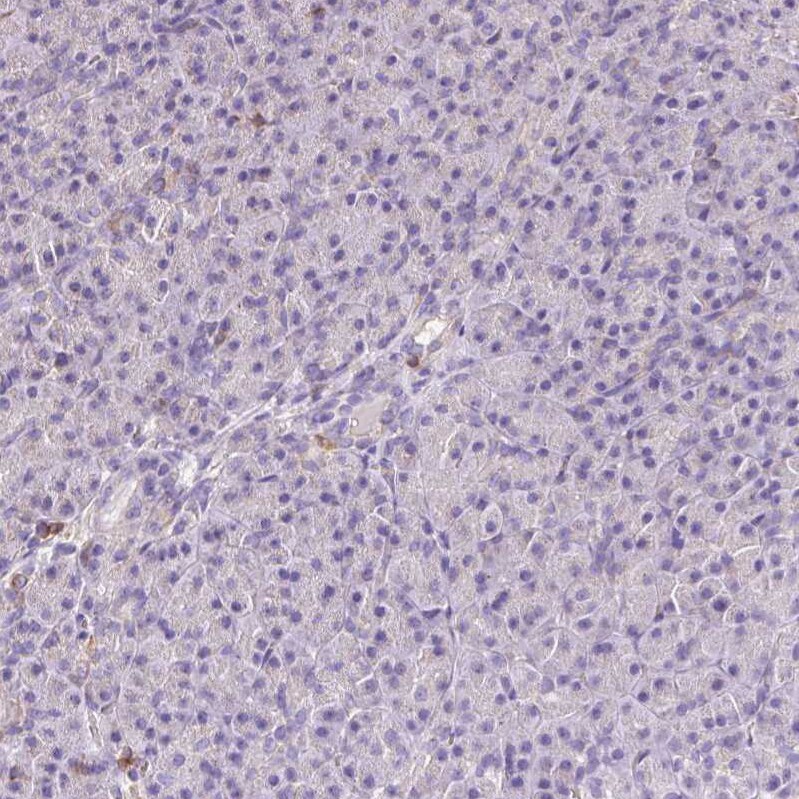 Mitofilin Antibody - BSA Free Immunohistochemistry-Paraffin: Mitofilin Antibody [NBP2-38286]