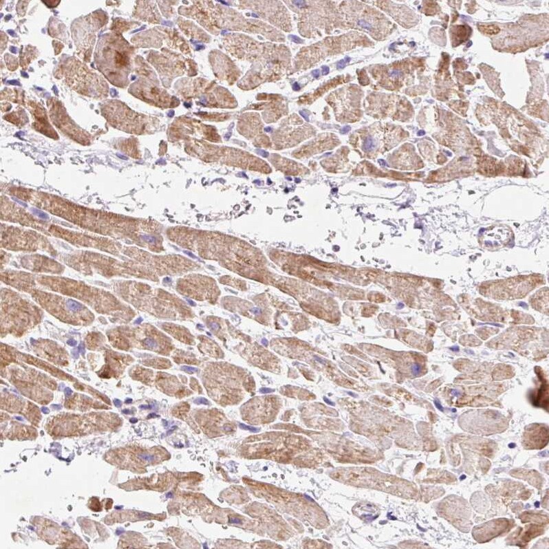 Mitofilin Antibody - BSA Free Immunohistochemistry-Paraffin: Mitofilin Antibody [NBP2-38286]