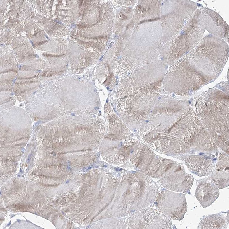 IGSF3 Antibody - BSA Free Immunohistochemistry-Paraffin: IGSF3 Antibody [NBP2-38292]
