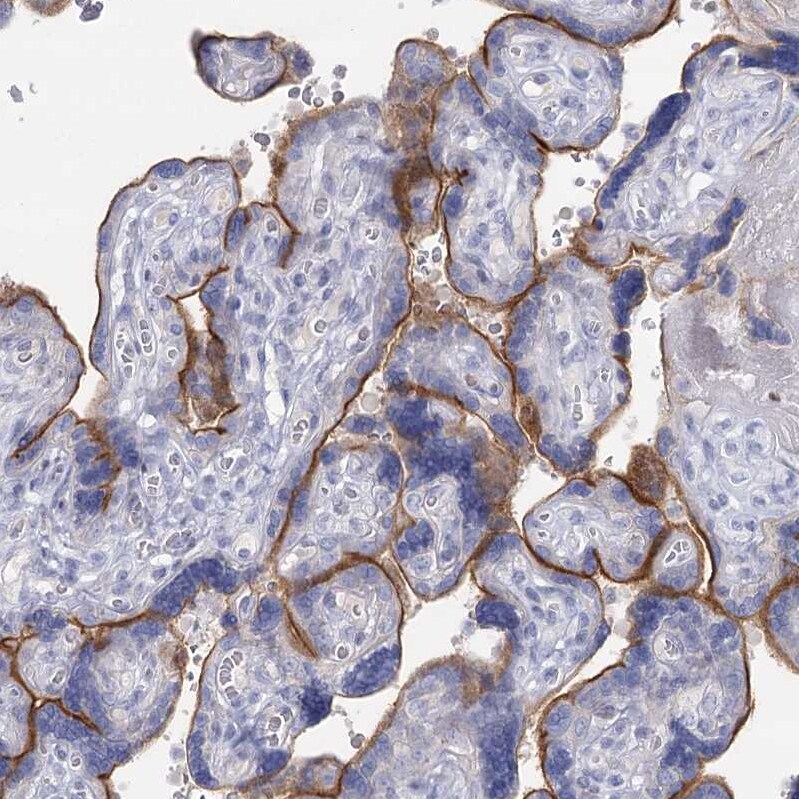 IGSF3 Antibody - BSA Free Immunohistochemistry-Paraffin: IGSF3 Antibody [NBP2-38292]