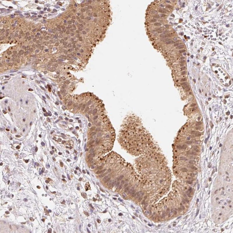 beta-Glucuronidase/GUSB Antibody - BSA Free Immunohistochemistry: beta-Glucuronidase/GUSB Antibody - BSA Free [NBP2-38293]