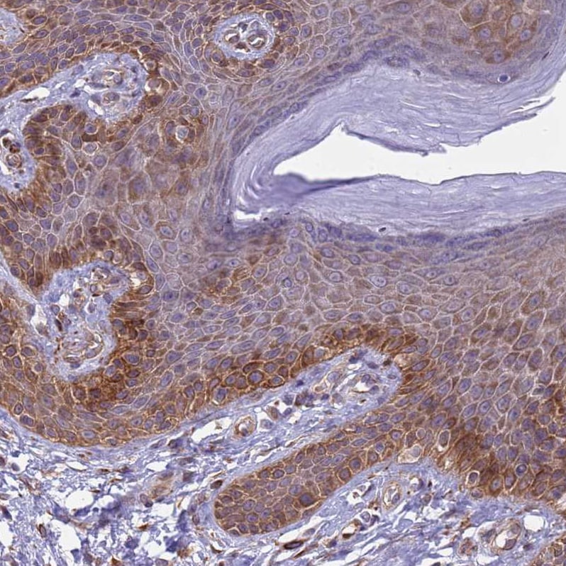 Integrin beta 4/CD104 Antibody - BSA Free Immunohistochemistry-Paraffin: Integrin beta 4/CD104 Antibody [NBP2-38297]