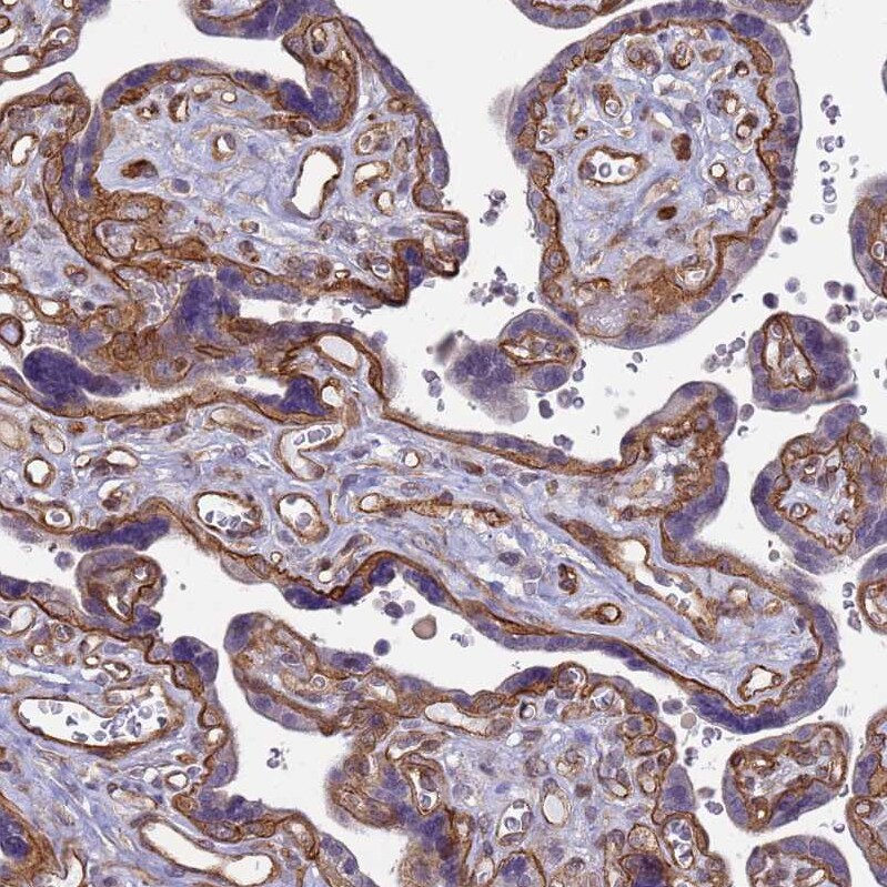 Integrin beta 4/CD104 Antibody - BSA Free Immunohistochemistry-Paraffin: Integrin beta 4/CD104 Antibody [NBP2-38297]