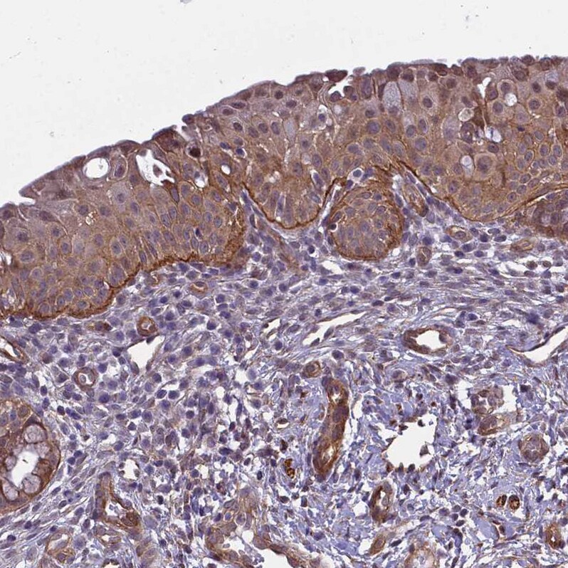 Integrin beta 4/CD104 Antibody - BSA Free Immunohistochemistry-Paraffin: Integrin beta 4/CD104 Antibody [NBP2-38297]