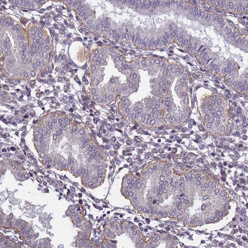Integrin beta 4/CD104 Antibody - BSA Free Immunohistochemistry-Paraffin: Integrin beta 4/CD104 Antibody [NBP2-38297]