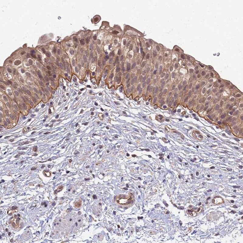 Integrin beta 4/CD104 Antibody - BSA Free Immunohistochemistry-Paraffin: Integrin beta 4/CD104 Antibody [NBP2-38298]