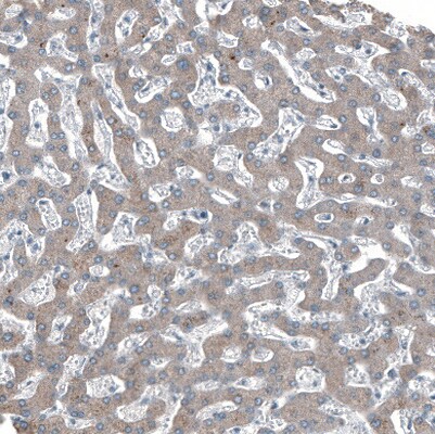 Integrin beta 4/CD104 Antibody - BSA Free Immunohistochemistry-Paraffin: Integrin beta 4/CD104 Antibody [NBP2-38298]
