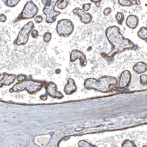 Integrin beta 4/CD104 Antibody - BSA Free Immunohistochemistry-Paraffin: Integrin beta 4/CD104 Antibody [NBP2-38298]