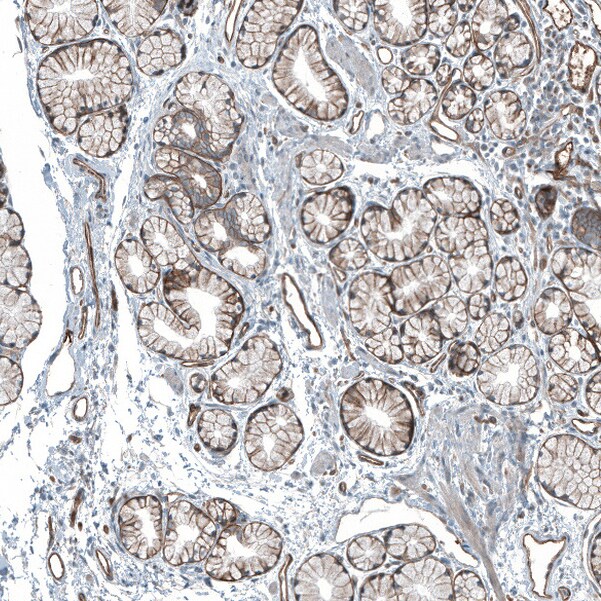 Integrin beta 4/CD104 Antibody - BSA Free Immunohistochemistry-Paraffin: Integrin beta 4/CD104 Antibody [NBP2-38298]