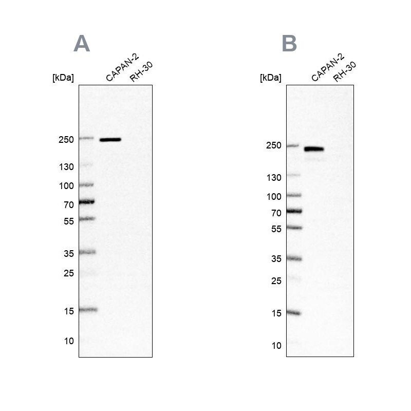 Integrin beta 4/CD104 Antibody Western Blot: Integrin beta 4/CD104 Antibody Antibody [NBP2-38298]