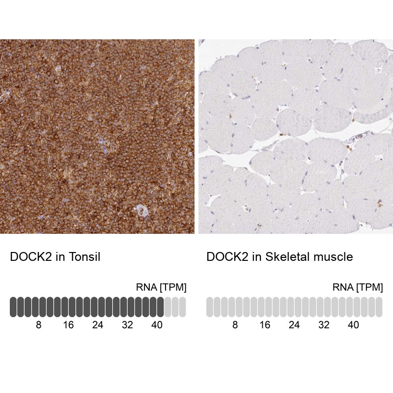 DOCK2 Antibody - BSA Free Immunohistochemistry-Paraffin: DOCK2 Antibody [NBP2-38303]