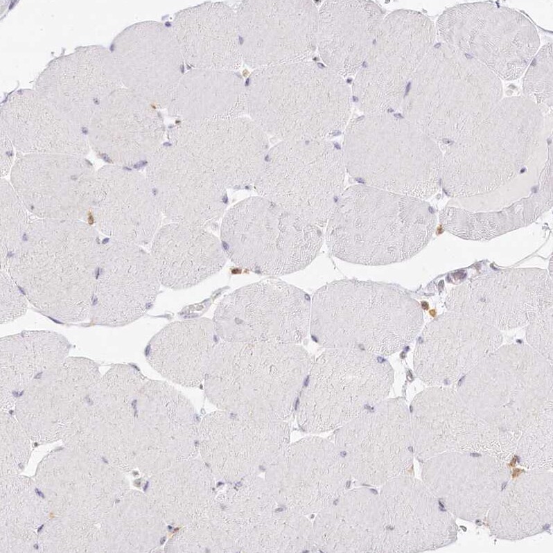 DOCK2 Antibody - BSA Free Immunohistochemistry-Paraffin: DOCK2 Antibody [NBP2-38303]