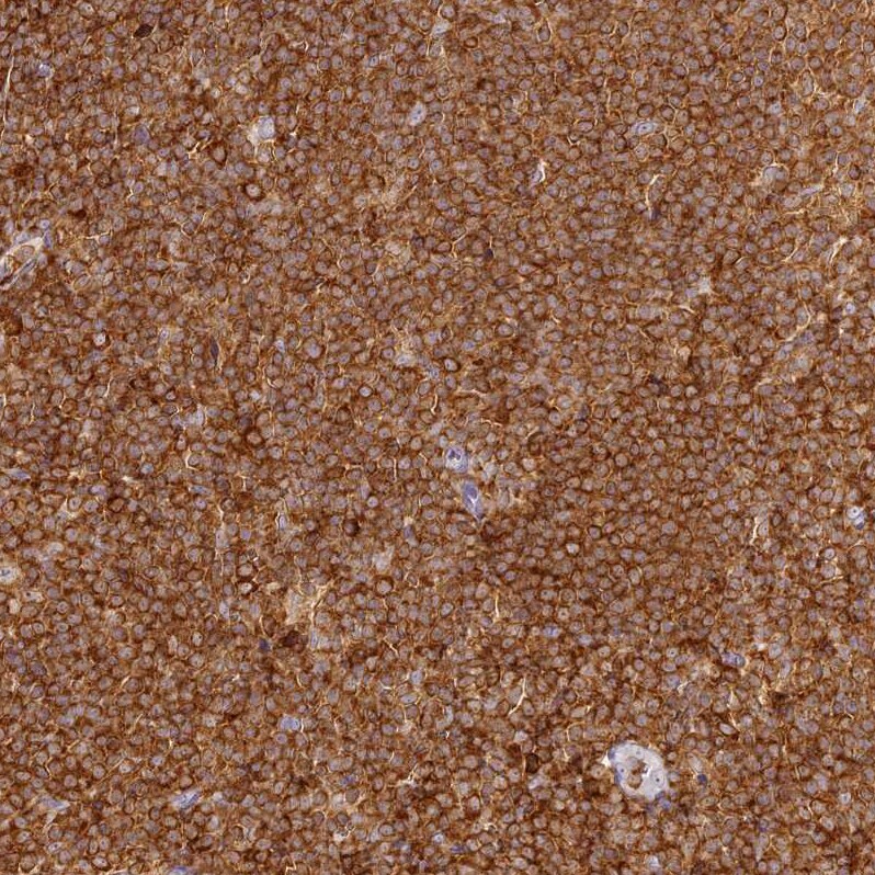 DOCK2 Antibody - BSA Free Immunohistochemistry-Paraffin: DOCK2 Antibody [NBP2-38303]