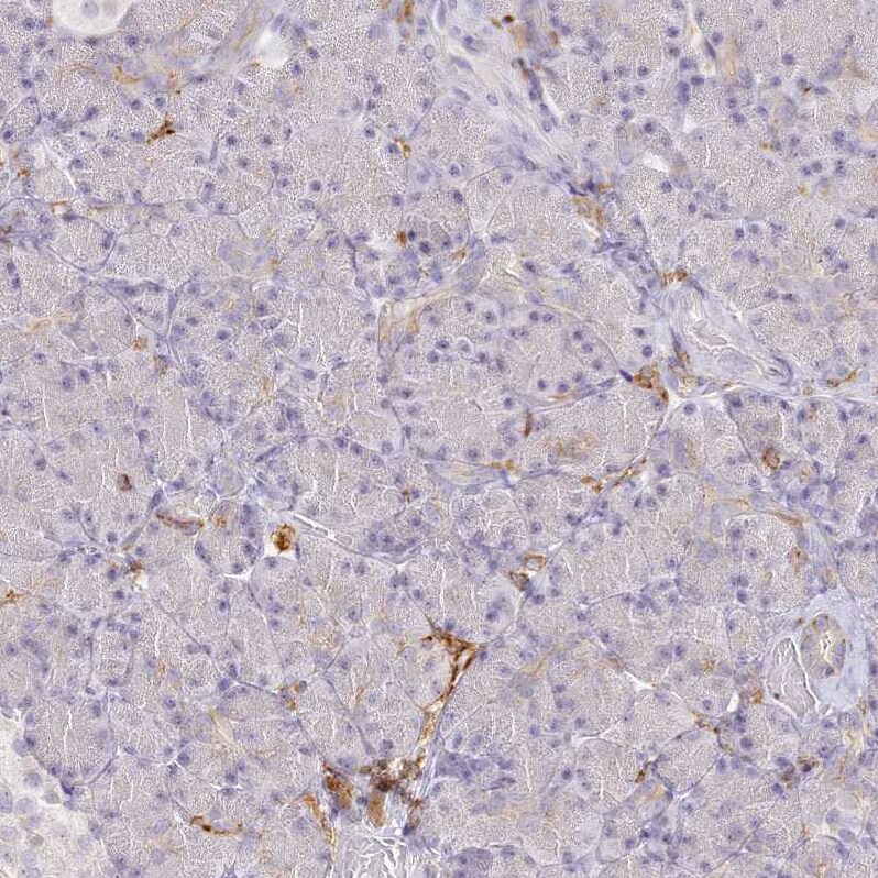 DOCK2 Antibody - BSA Free Immunohistochemistry-Paraffin: DOCK2 Antibody [NBP2-38303]