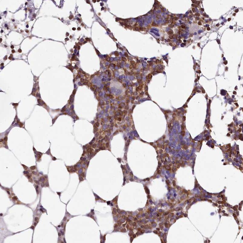 DOCK2 Antibody - BSA Free Immunohistochemistry-Paraffin: DOCK2 Antibody [NBP2-38303]