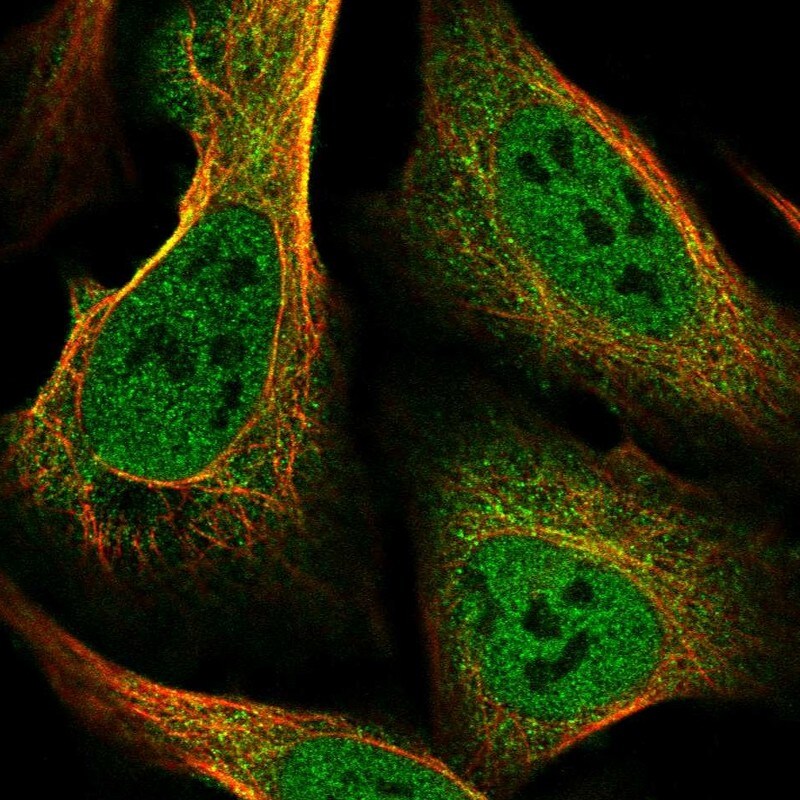 SLC39A10 Antibody - BSA Free Immunocytochemistry/ Immunofluorescence: SLC39A10 Antibody [NBP2-38306]