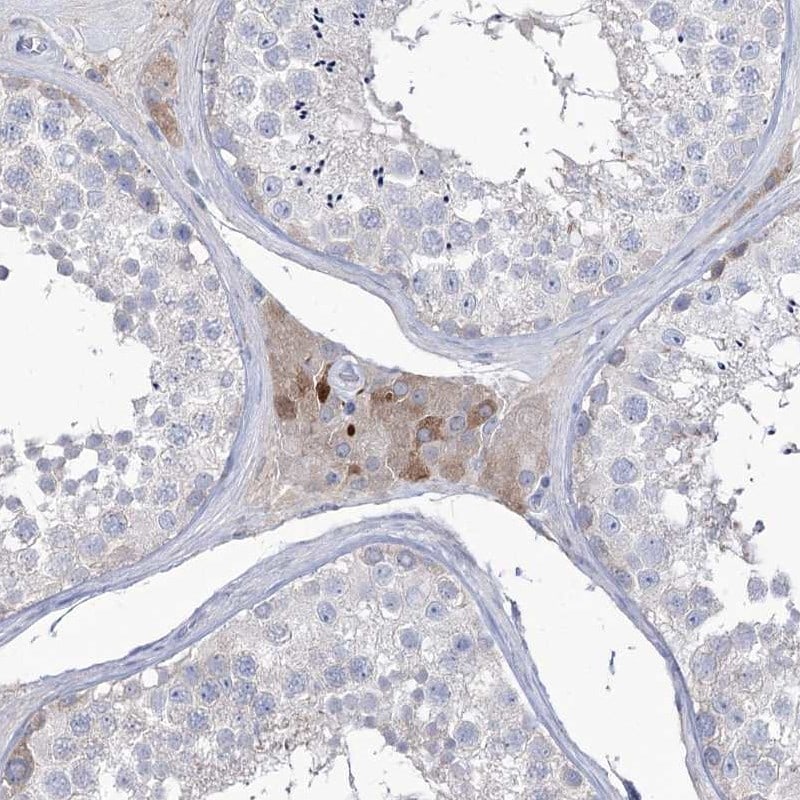 ZNF622 Antibody - BSA Free Immunohistochemistry-Paraffin: ZNF622 Antibody [NBP2-38307]