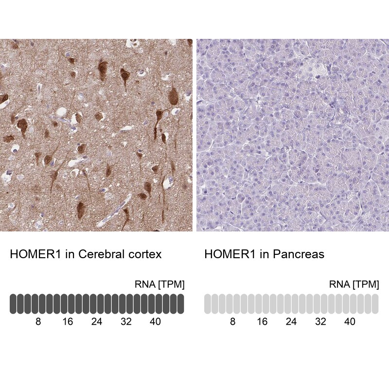 HOMER1 Antibody - BSA Free Immunohistochemistry-Paraffin: HOMER1 Antibody [NBP2-38309]
