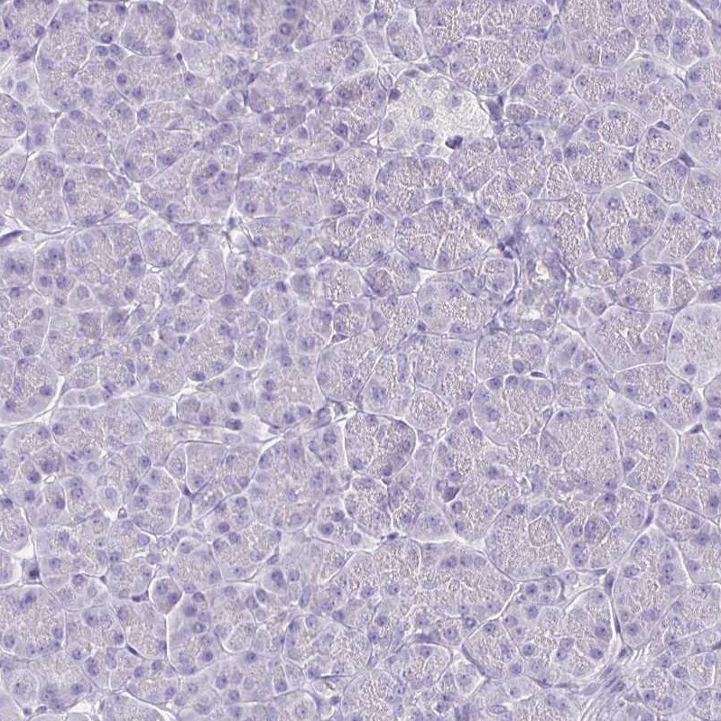 HOMER1 Antibody - BSA Free Immunohistochemistry-Paraffin: HOMER1 Antibody [NBP2-38309]
