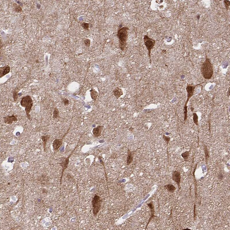 HOMER1 Antibody - BSA Free Immunohistochemistry-Paraffin: HOMER1 Antibody [NBP2-38309]