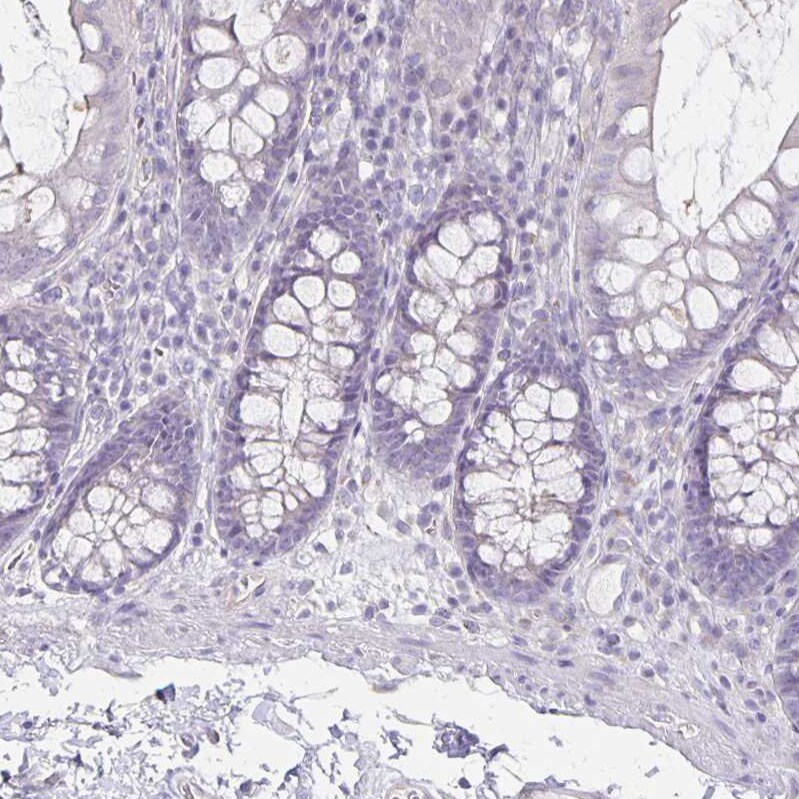 HOMER1 Antibody - BSA Free Immunohistochemistry-Paraffin: HOMER1 Antibody [NBP2-38309]