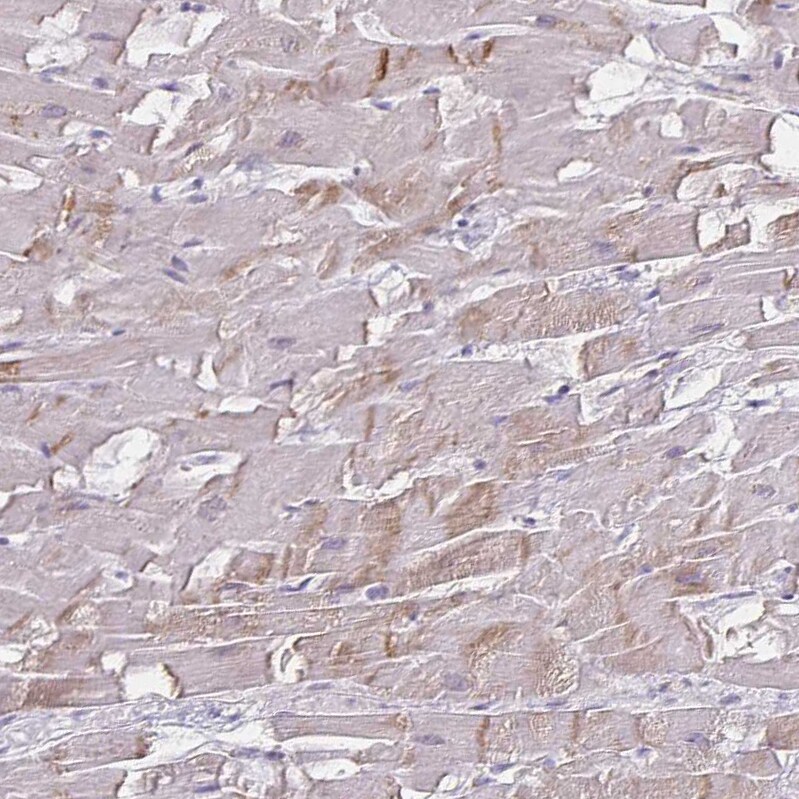 HOMER1 Antibody - BSA Free Immunohistochemistry-Paraffin: HOMER1 Antibody [NBP2-38309]