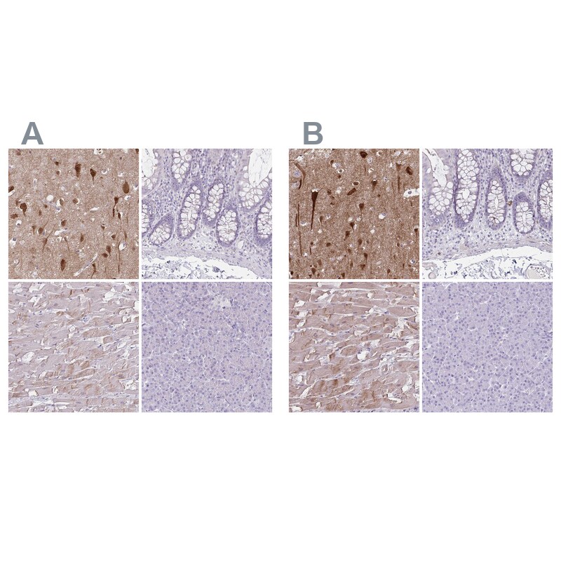 HOMER1 Antibody - BSA Free Immunohistochemistry-Paraffin: HOMER1 Antibody [NBP2-38309]
