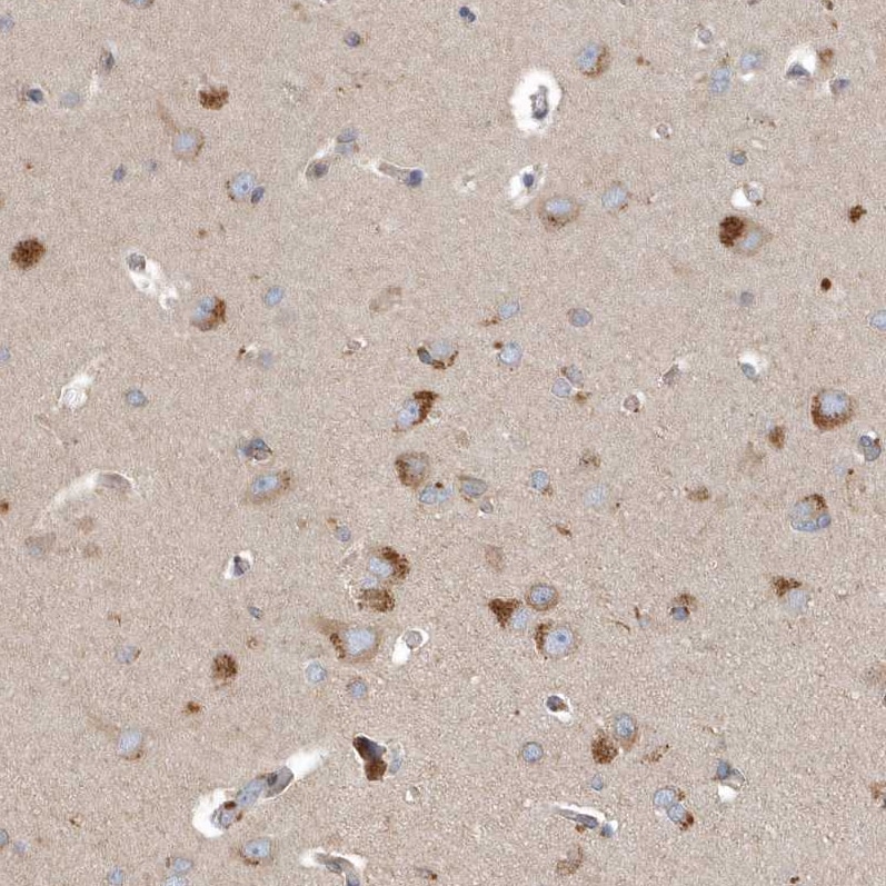 SCFD2 Antibody - BSA Free Immunohistochemistry: SCFD2 Antibody - BSA Free [NBP2-38310]