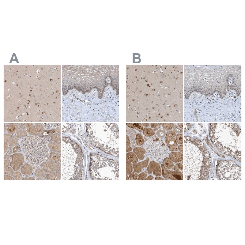 SCFD2 Antibody - BSA Free Immunohistochemistry: SCFD2 Antibody - BSA Free [NBP2-38310]