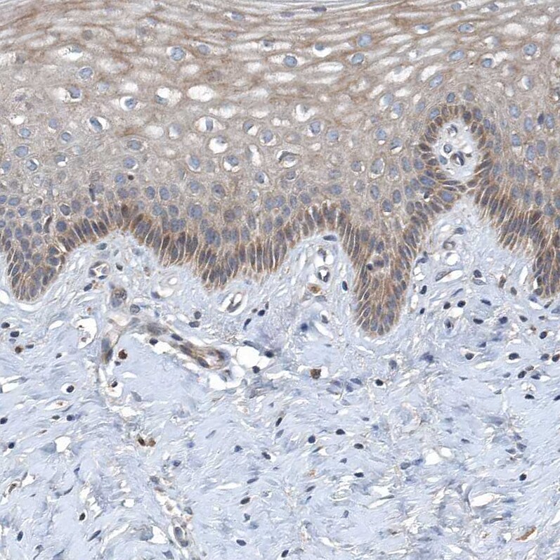 SCFD2 Antibody - BSA Free Immunohistochemistry: SCFD2 Antibody - BSA Free [NBP2-38310]