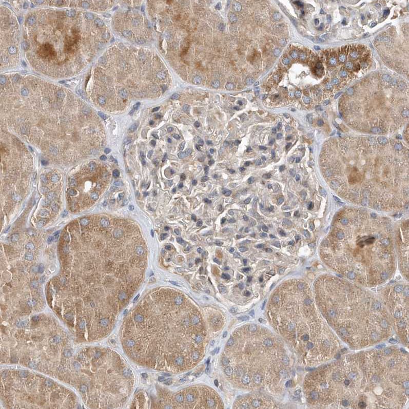 SCFD2 Antibody - BSA Free Immunohistochemistry: SCFD2 Antibody - BSA Free [NBP2-38310]