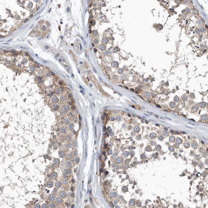 SCFD2 Antibody - BSA Free Immunohistochemistry: SCFD2 Antibody - BSA Free [NBP2-38310]