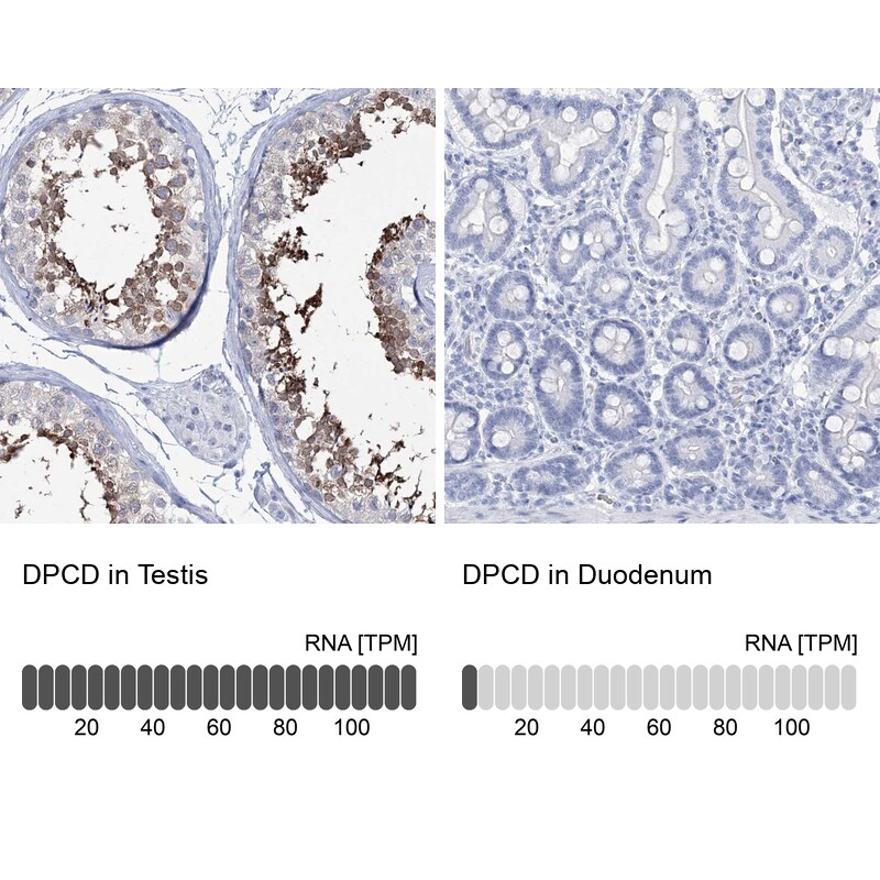 DKFZp566F084 Antibody - BSA Free Immunohistochemistry-Paraffin: DKFZp566F084 Antibody [NBP2-38312]