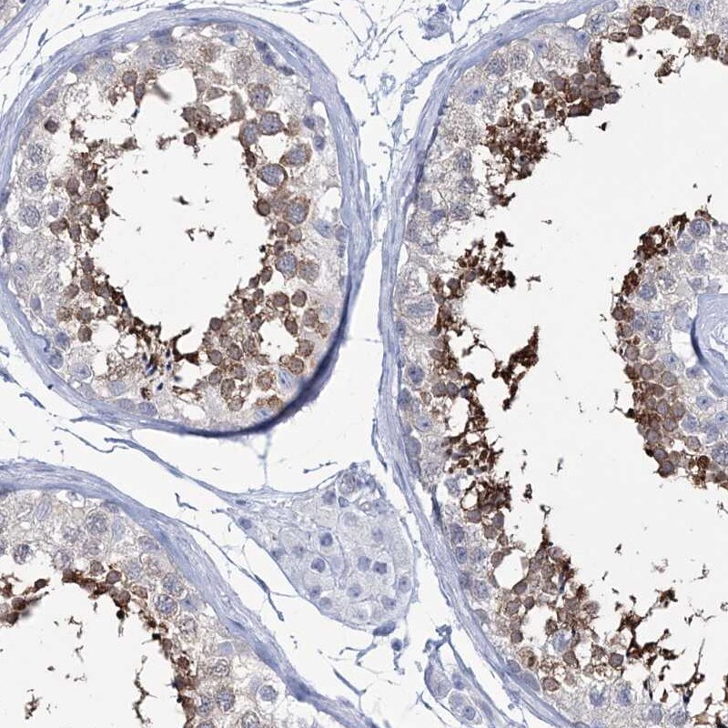 DKFZp566F084 Antibody - BSA Free Immunohistochemistry-Paraffin: DKFZp566F084 Antibody [NBP2-38312]