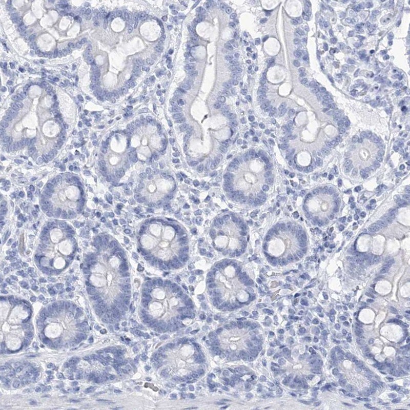 DKFZp566F084 Antibody - BSA Free Immunohistochemistry-Paraffin: DKFZp566F084 Antibody [NBP2-38312]