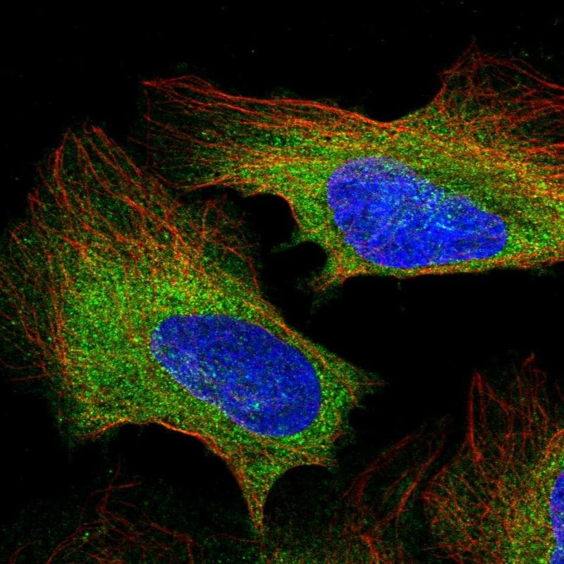 PLC-gamma 1 Antibody - BSA Free Immunocytochemistry/ Immunofluorescence: PLC-gamma 1 Antibody [NBP2-38316]