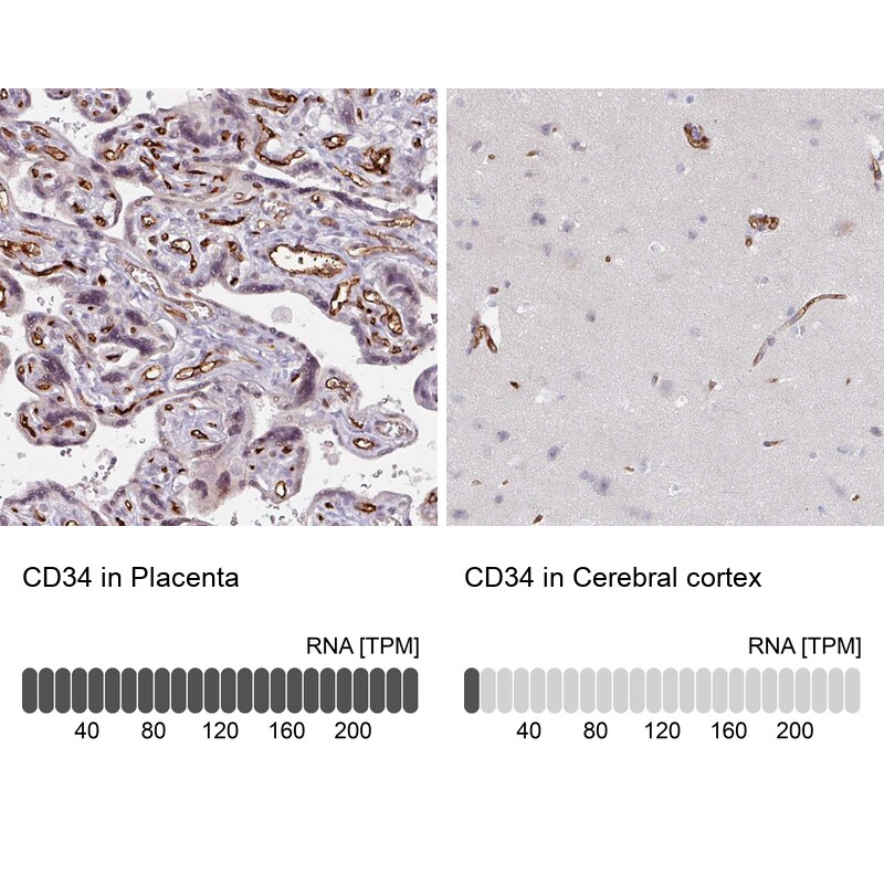 CD34 Antibody - BSA Free Immunohistochemistry-Paraffin: CD34 Antibody [NBP2-38322]