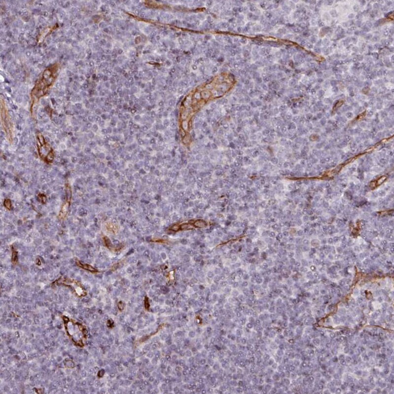 CD34 Antibody - BSA Free Immunohistochemistry-Paraffin: CD34 Antibody [NBP2-38322]