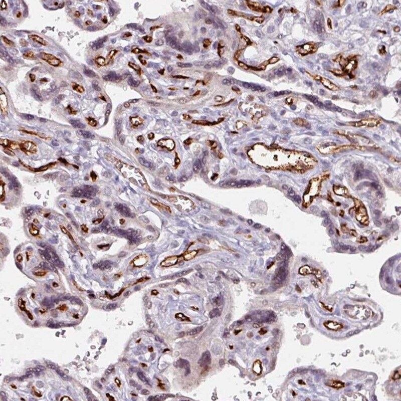 CD34 Antibody - BSA Free Immunohistochemistry-Paraffin: CD34 Antibody [NBP2-38322]