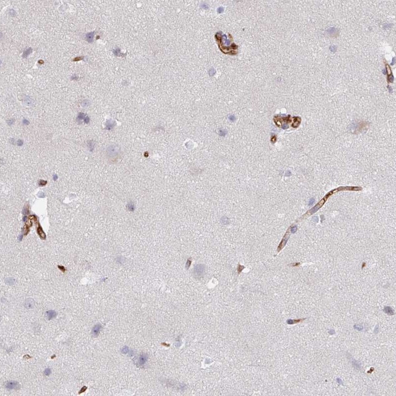 CD34 Antibody - BSA Free Immunohistochemistry-Paraffin: CD34 Antibody [NBP2-38322]