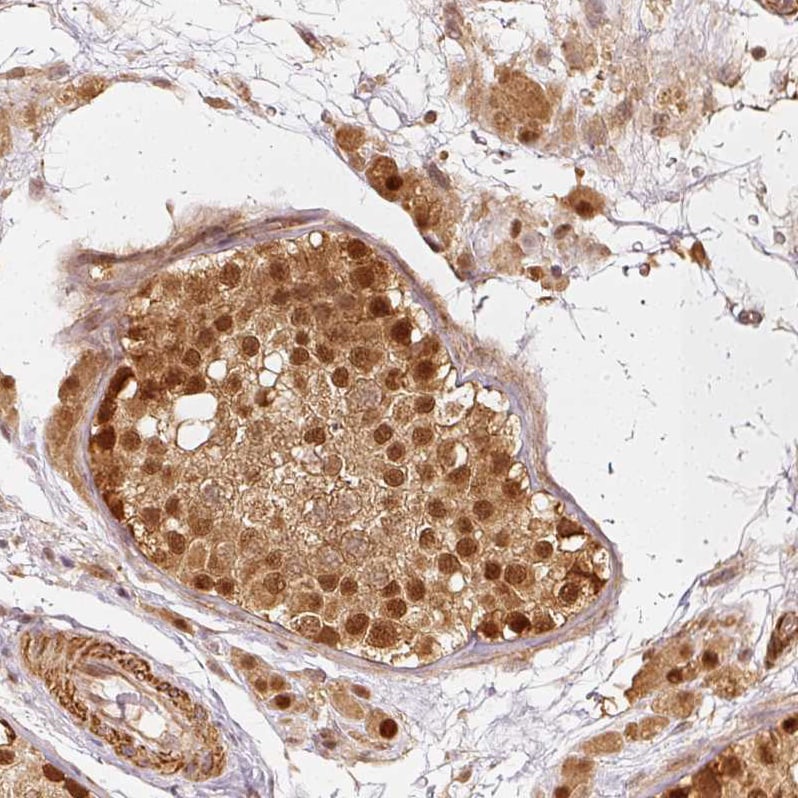 Rpn2 Antibody - BSA Free Immunohistochemistry-Paraffin: Rpn2 Antibody [NBP2-38323]