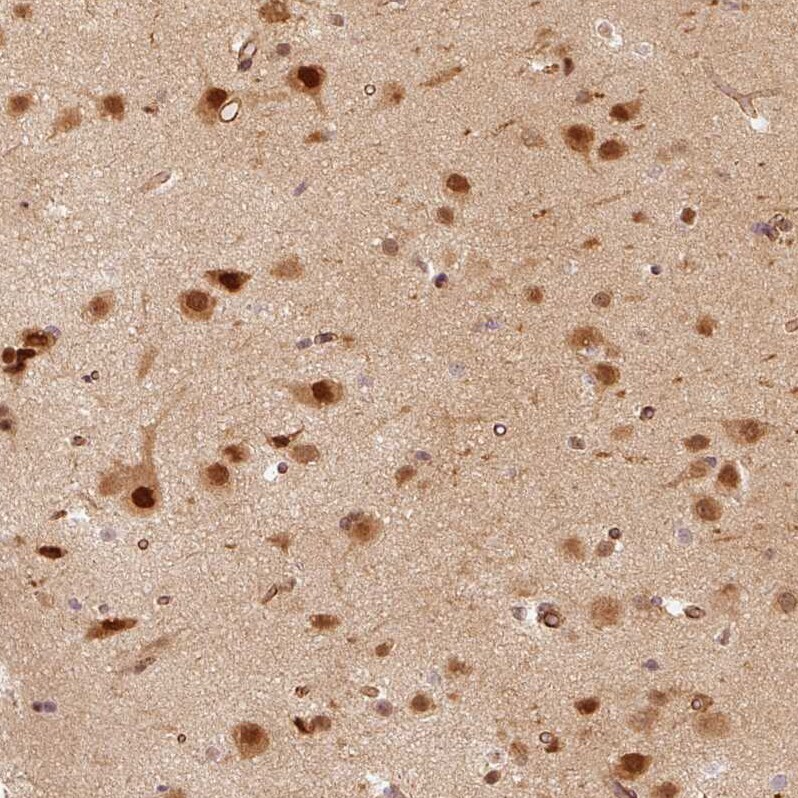 Rpn2 Antibody - BSA Free Immunohistochemistry-Paraffin: Rpn2 Antibody [NBP2-38323]