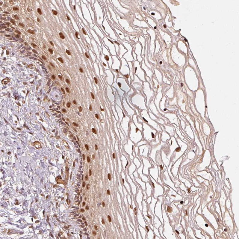 Rpn2 Antibody - BSA Free Immunohistochemistry-Paraffin: Rpn2 Antibody [NBP2-38323]